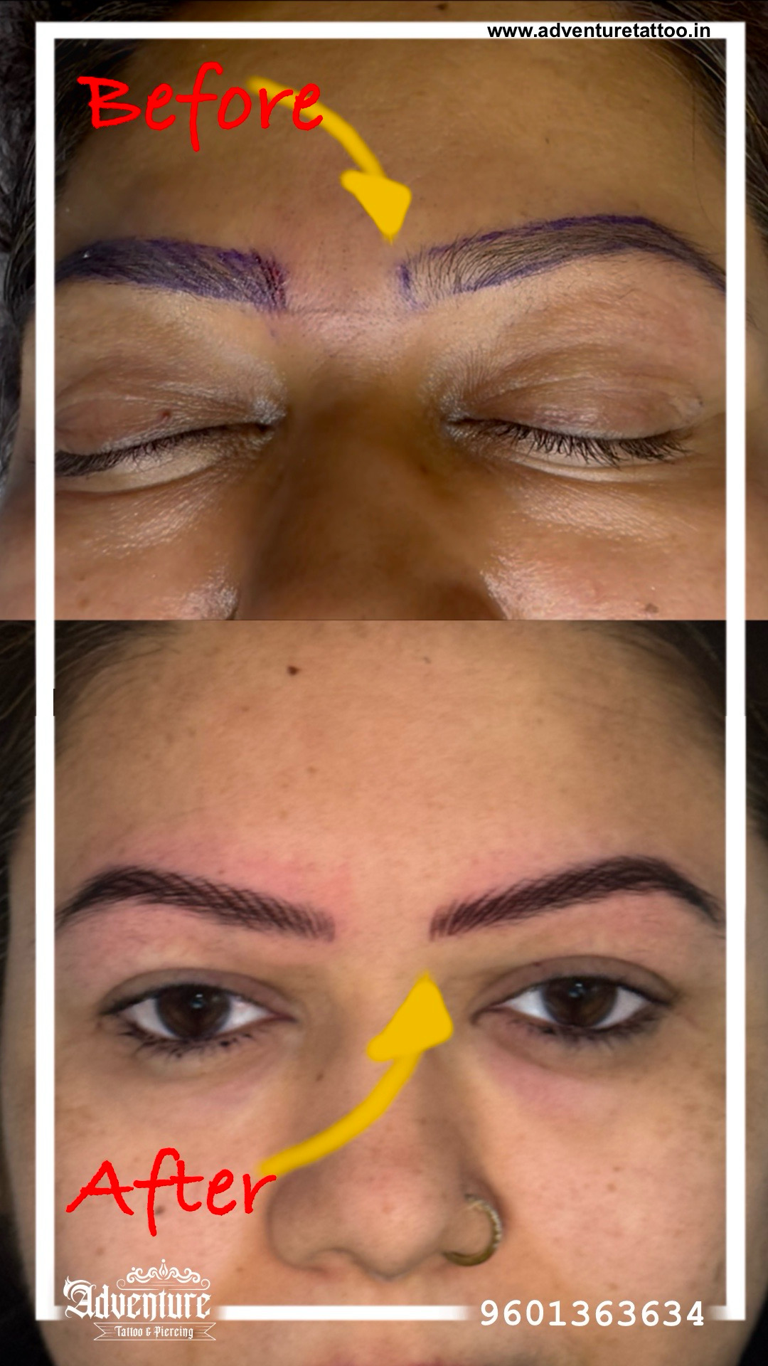 Microblading Before After Ahmedabad
